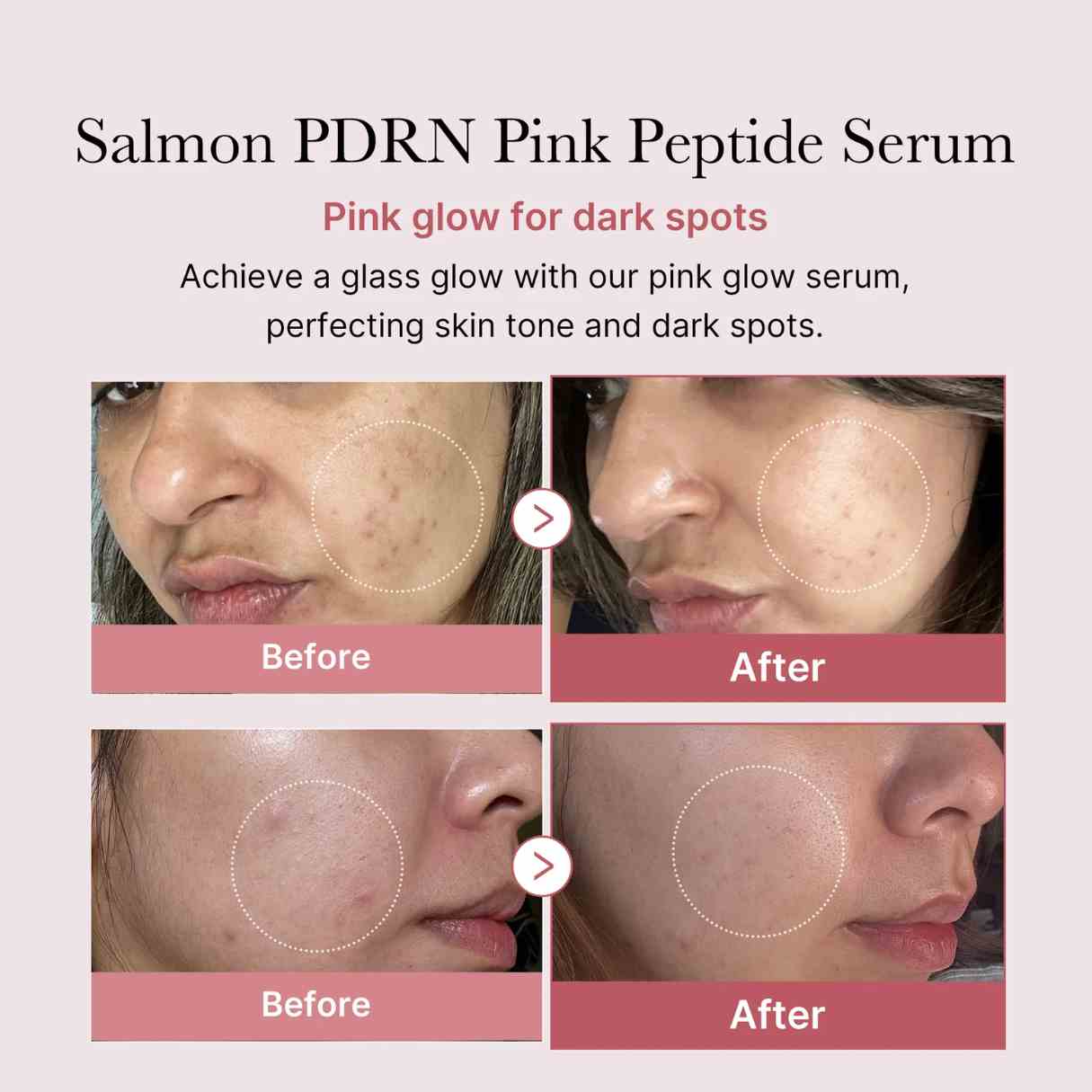 Medicube PDRN Pink Peptide Serum – Revitalize & Glow 30 ML